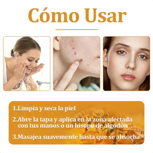 🎁 Paga 1 - Lleva 2 😍 🌿Bee Venom Cream ✨¡Elimina una amplia gama de problemas de la piel