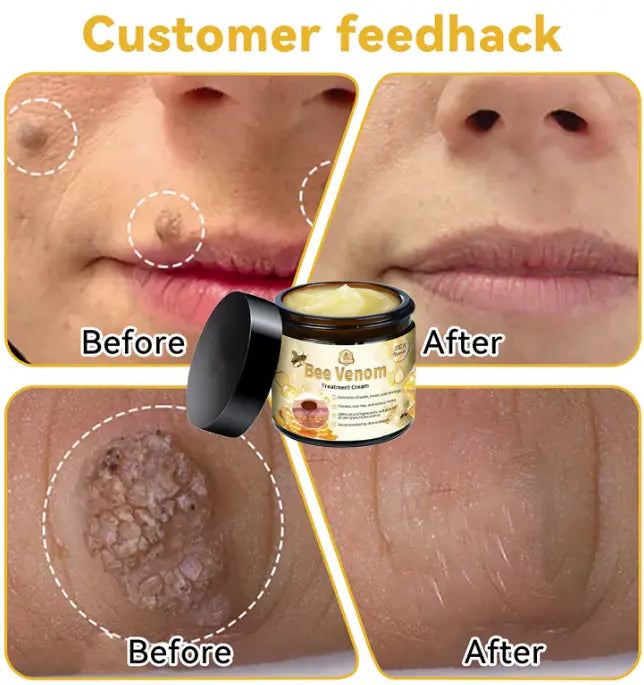 🎁 Paga 1 - Lleva 2 😍 🌿Bee Venom Cream ✨¡Elimina una amplia gama de problemas de la piel